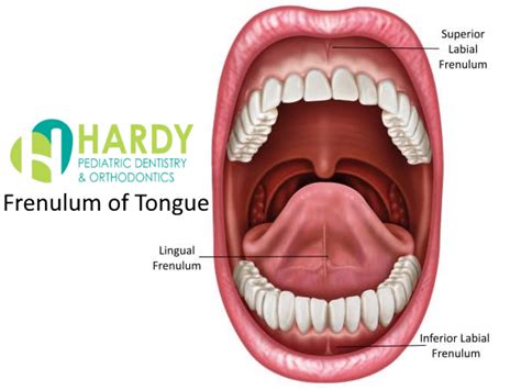 Ridge of tissue e.g. fold of skin beneath tongue .